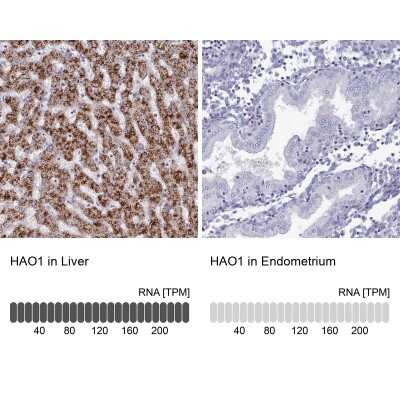 Immunohistochemistry-Paraffin: Hydroxyacid Oxidase-1/HAO-1 Antibody [NBP2-14080]