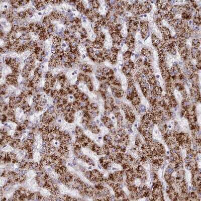 Immunohistochemistry-Paraffin: Hydroxyacid Oxidase-1/HAO-1 Antibody [NBP2-14080]