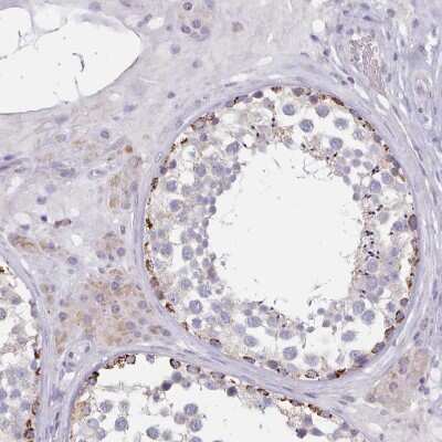 Immunohistochemistry-Paraffin: Hydroxyacid Oxidase-1/HAO-1 Antibody [NBP2-14080]