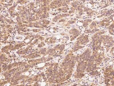 Immunohistochemistry-Paraffin: Hydroxyacid Oxidase-1/HAO-1 Antibody [NBP2-99929]