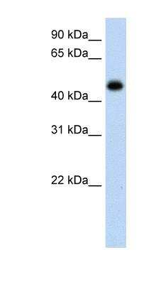 Western Blot: Hydroxyacid Oxidase-1/HAO-1 Antibody [NBP1-55294]