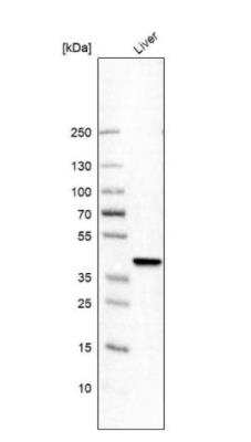 Western Blot: Hydroxyacid Oxidase-1/HAO-1 Antibody [NBP2-14080]