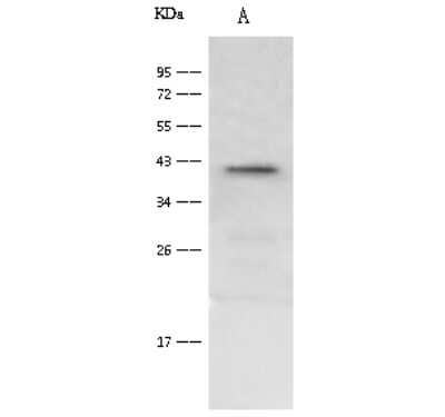 Western Blot: Hydroxyacid Oxidase-1/HAO-1 Antibody [NBP2-99929]