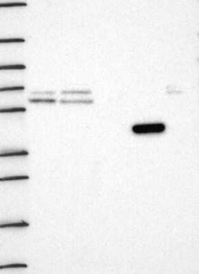 Western Blot: Hydroxyacid Oxidase-1/HAO-1 Antibody [NBP3-16999]