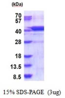 SDS-PAGE: Recombinant Human Hydroxylysine kinase His Protein [NBP2-51865]