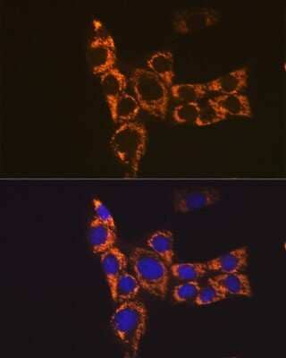 Immunocytochemistry/ Immunofluorescence: I-Ab Antibody - Azide and BSA Free [NBP3-15581]