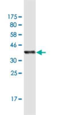 Western Blot: IA-2/PTPRN Antibody (8E3) [H00005798-M07]