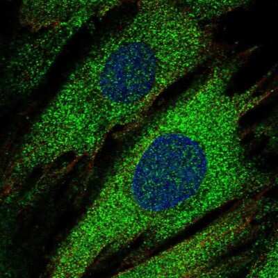 Immunocytochemistry/ Immunofluorescence: IA-2/PTPRN Antibody [NBP2-58897]