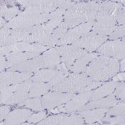 Immunohistochemistry-Paraffin: IA-2/PTPRN Antibody [NBP1-83128]