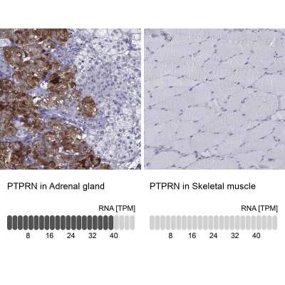 Immunohistochemistry-Paraffin: IA-2/PTPRN Antibody [NBP1-83128]