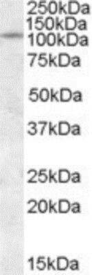 Western Blot: IA-2/PTPRN Antibody [NBP1-00134]