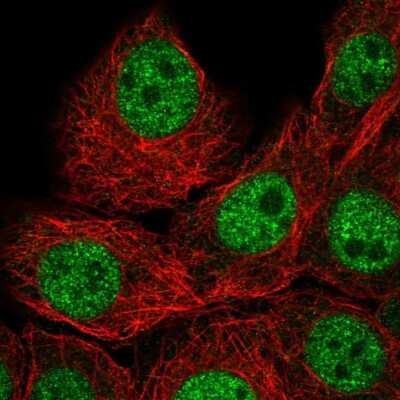 Immunocytochemistry/ Immunofluorescence: IAH1 Antibody [NBP2-57685]