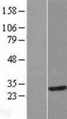 Western Blot: IAH1 Overexpression Lysate [NBL1-11799]