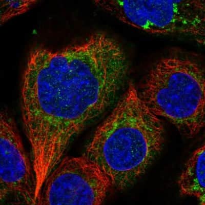 Immunocytochemistry/ Immunofluorescence: IARS2 Antibody [NBP1-84637]