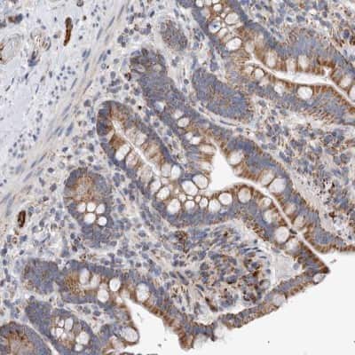 Immunohistochemistry-Paraffin: IARS2 Antibody [NBP1-84637]