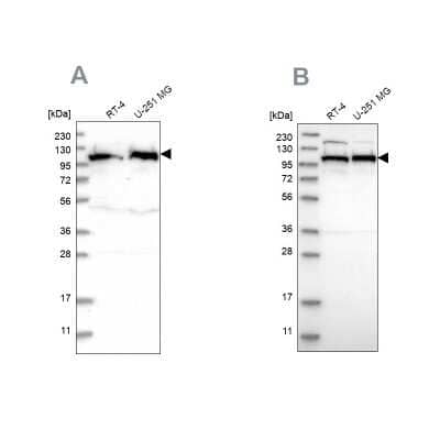 Western Blot: IARS2 Antibody [NBP1-84638]