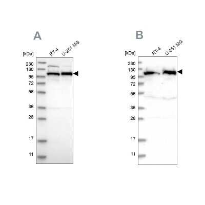 Western Blot: IARS2 Antibody [NBP1-84639]