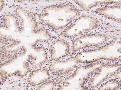 Immunohistochemistry-Paraffin: IBA57 Antibody [NBP2-98047]