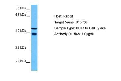 Western Blot: IBA57 Antibody [NBP2-87616]