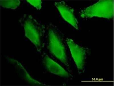 Immunocytochemistry/ Immunofluorescence: IBRDC1 Antibody (4B1) [H00154214-M01]