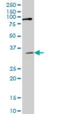 Western Blot: IBRDC1 Antibody (4B1) [H00154214-M01]