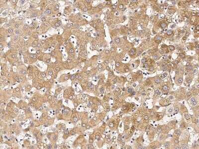 Immunohistochemistry-Paraffin: IBRDC1 Antibody [NBP2-99001]