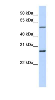 Western Blot: IBRDC1 Antibody [NBP1-59776]