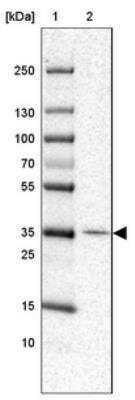 Western Blot: IBRDC1 Antibody [NBP1-88253]