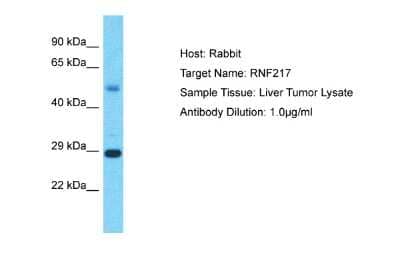 Western Blot: IBRDC1 Antibody [NBP2-87617]