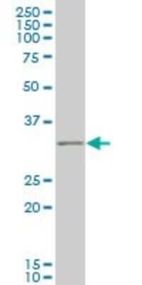 Western Blot: IBRDC2 Antibody (4F1) [H00255488-M02]