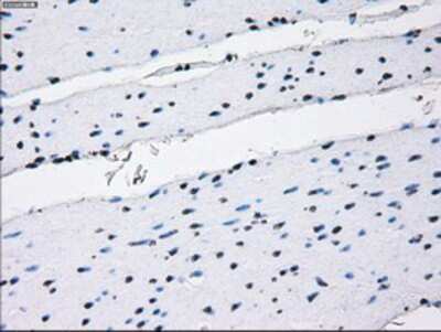 Immunohistochemistry-Paraffin: IBRDC2 Antibody (OTI9H10) [NBP2-02128]