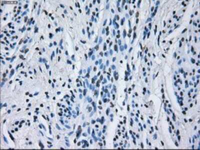 Immunohistochemistry-Paraffin: IBRDC2 Antibody (OTI9H10) [NBP2-02128]