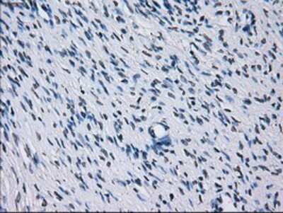 Immunohistochemistry-Paraffin: IBRDC2 Antibody (OTI9H10) [NBP2-02128]