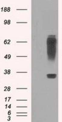 Western Blot: IBRDC2 Antibody (OTI9H10) [NBP2-02128]