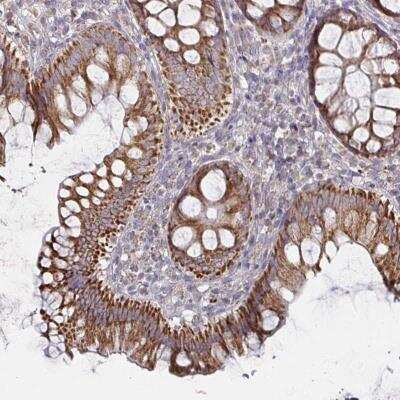 Immunohistochemistry-Paraffin: IBRDC2 Antibody [NBP2-37941]