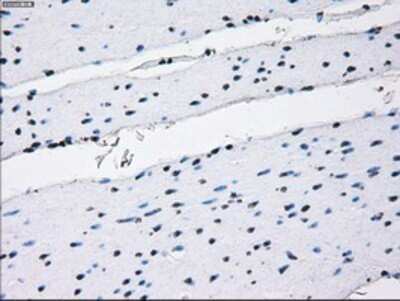 Immunohistochemistry: IBRDC2 Antibody (OTI9H10) - Azide and BSA Free [NBP2-72470]