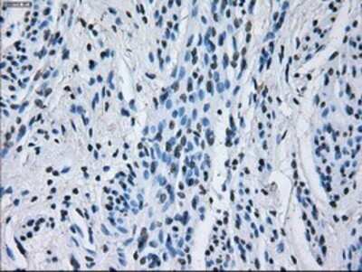 Immunohistochemistry: IBRDC2 Antibody (OTI9H10) - Azide and BSA Free [NBP2-72470]