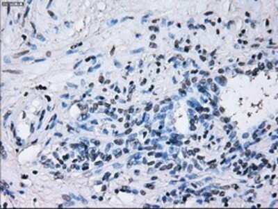 Immunohistochemistry: IBRDC2 Antibody (OTI9H10) - Azide and BSA Free [NBP2-72470]