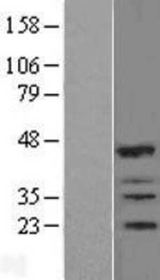 Western Blot: IBRDC2 Overexpression Lysate [NBL1-15428]