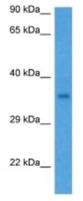 Western Blot: IBSP/Sialoprotein II Antibody [NBP3-10985]