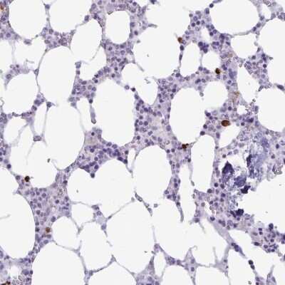 Immunohistochemistry: IBTK Antibody [NBP2-38581]