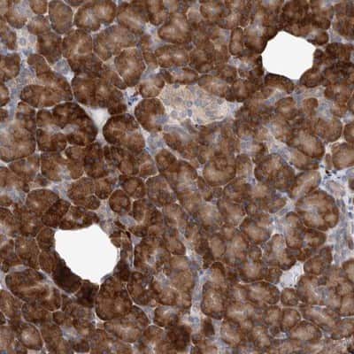 Immunohistochemistry-Paraffin: IBTK Antibody [NBP1-88512]