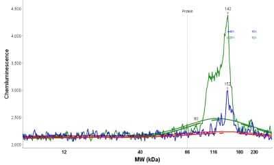 Simple Western: IBTK Antibody [NBP1-88512]