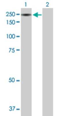 Western Blot: IBTK Antibody [H00025998-B01P]