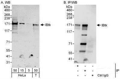 Western Blot: IBTK Antibody [NBP1-50033]