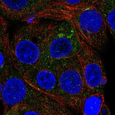 Immunocytochemistry/ Immunofluorescence: ICA1 Antibody [NBP2-56868]