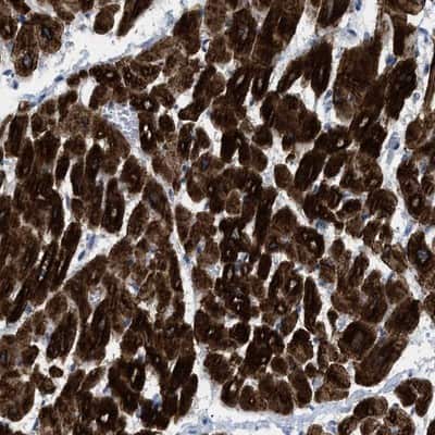 Immunohistochemistry-Paraffin: ICA1 Antibody [NBP1-83124]