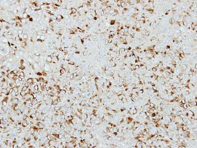 Immunohistochemistry-Paraffin: ICA1 Antibody [NBP2-16909]