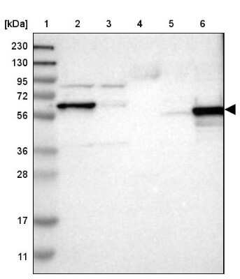 Western Blot: ICA1 Antibody [NBP1-83124]