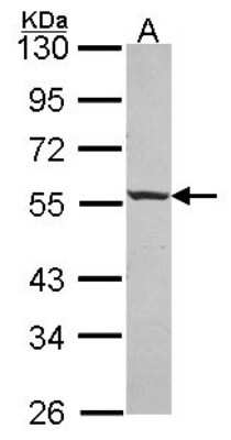 Western Blot: ICA1 Antibody [NBP2-16909]